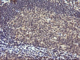Monoclonal Mouse anti-Human PIK3R5 Antibody (clone OTI4G9, IHC, IF, WB)
