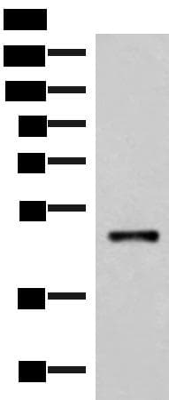IRX2 Antibody