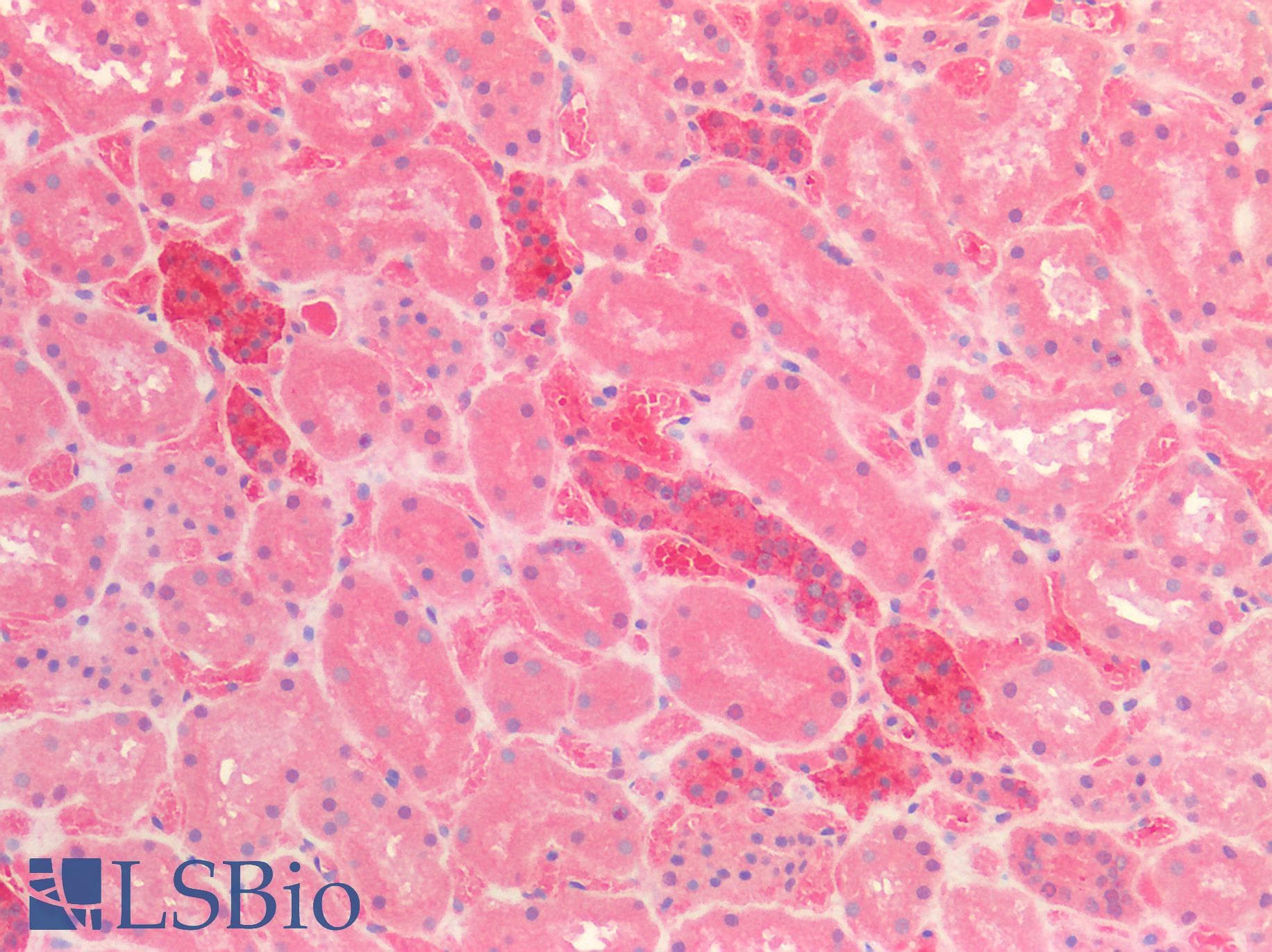 PathPlus™ CALB1 / Calbindin Antibody (aa2-261)