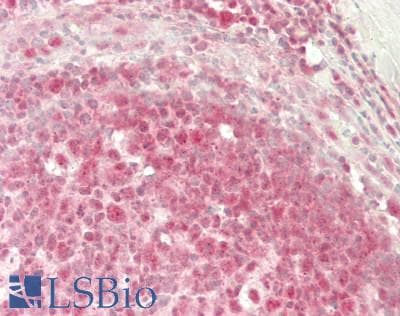 Polyclonal Rabbit anti-Human PKD3 / PRKD3 Antibody (Internal, IHC, WB)