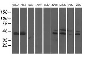 IHC-plus™ Monoclonal Mouse anti-Human DDX39B / UAP56 Antibody (clone 2E4, IHC, IF, WB)