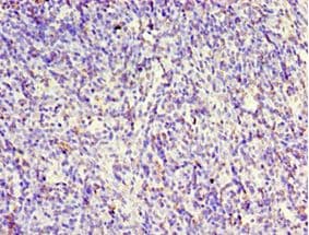 Polyclonal Rabbit anti-Human CLK2 Antibody (aa240-499, IHC)