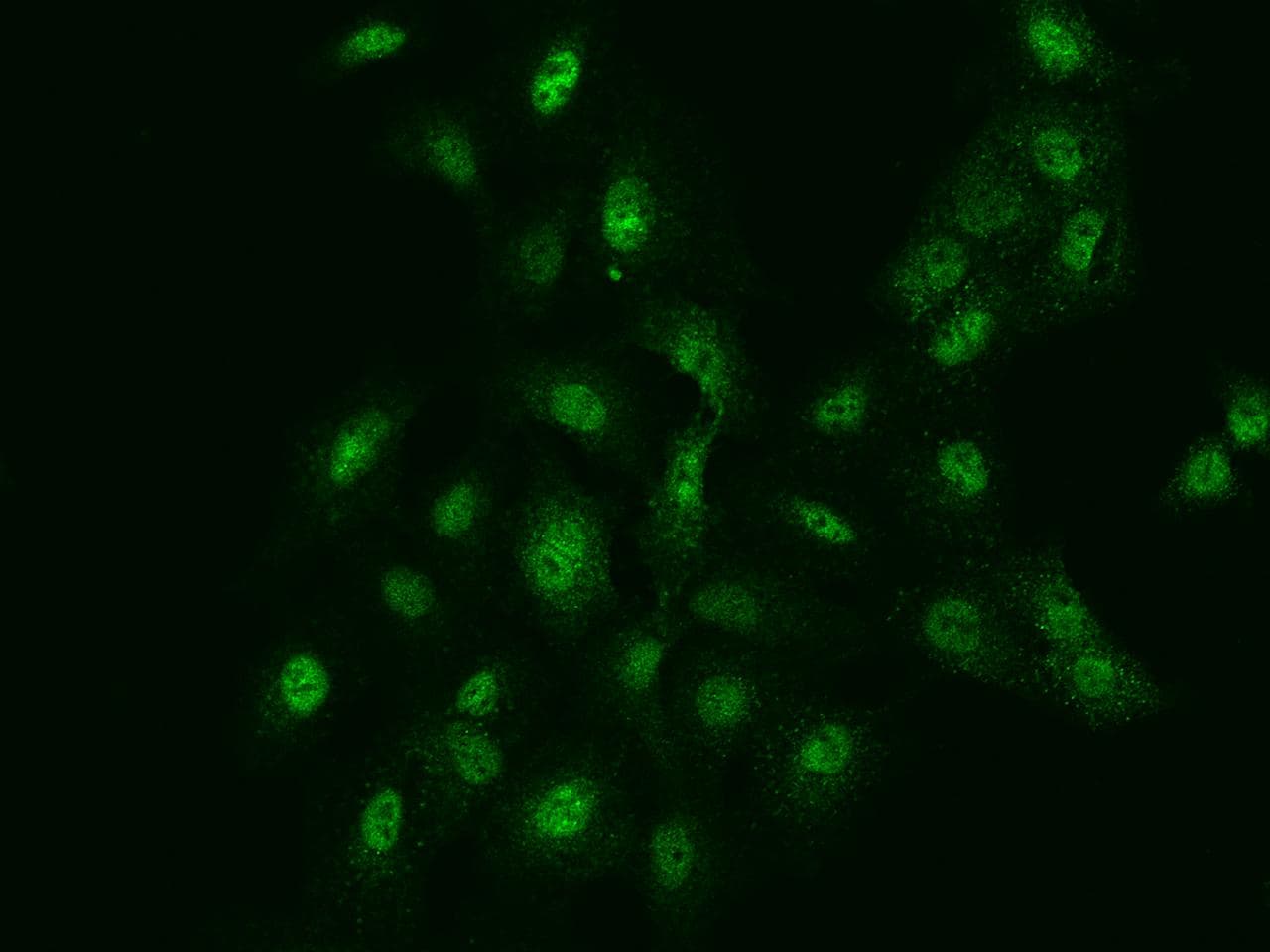 FANCG Antibody