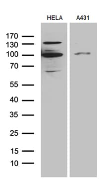 MLH1 Antibody (aa1-298, clone OTI10F9)