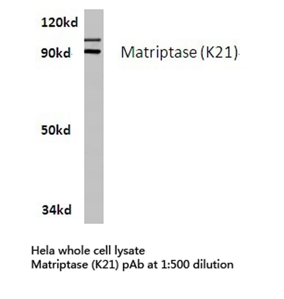 Polyclonal Rabbit anti-Human ST14 / Matriptase Antibody (Lys21, IF, WB)