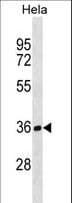 TBCB / CKAP1 Antibody (aa42-70)