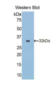 RELN / Reelin Antibody (aa2400-2610, HRP)
