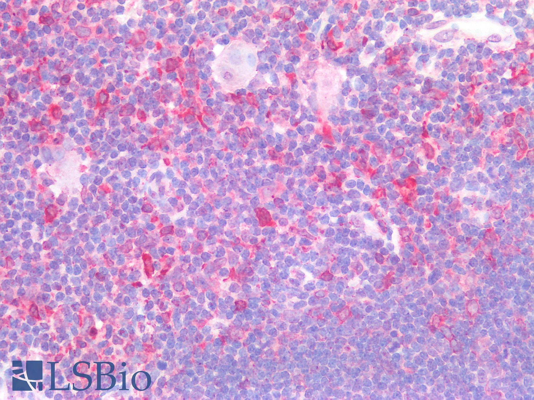 IHC-plus™ CD74 / CLIP Antibody (Internal Region)