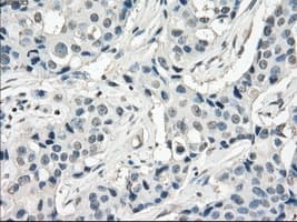 FRA-1 / FOSL1 Antibody (clone OTI12F9)