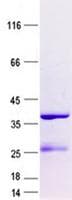 Human CENPW / C6orf173 Protein (Recombinant GST, N-terminus + His, C-terminus)