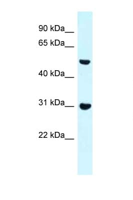 Polyclonal Rabbit anti-Mouse FNBP1 / FBP17 Antibody (N-Terminus, WB)