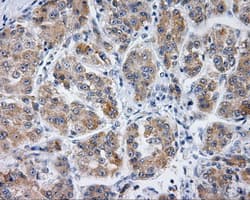 Monoclonal Mouse anti-Human PLEK / Pleckstrin Antibody (clone OTI6B5, IHC, IF, WB)