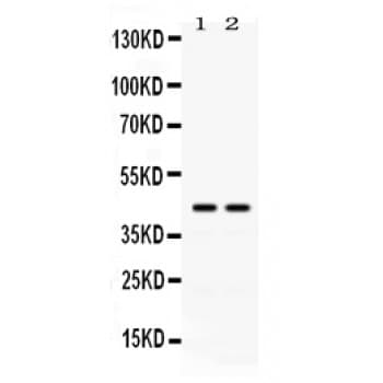 RAD51C Antibody (aa177-207)
