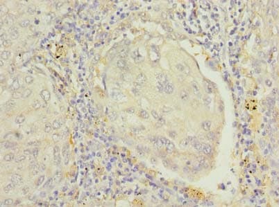Polyclonal Rabbit anti-Human RAP1B Antibody (IHC, WB)
