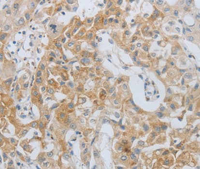 MMP25 / Leukolysin Antibody