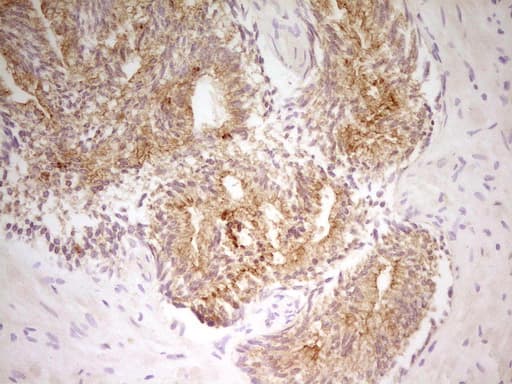 Monoclonal Mouse anti-Human PAK4 Antibody (clone OTI1C7, aa1-308, IHC, WB)