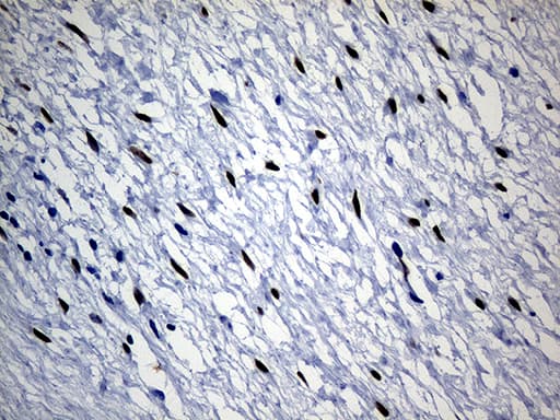 SATB2 Antibody (aa447-733, clone OTI7E11)