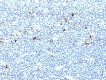 HLA-A25 + HLA-Aw32 Antibody (clone CATA-1)