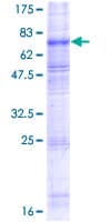 Human SLC7A11 / XCT Protein (Recombinant GST)