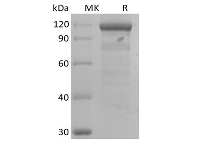 Human WNT3A Protein (Recombinant)
