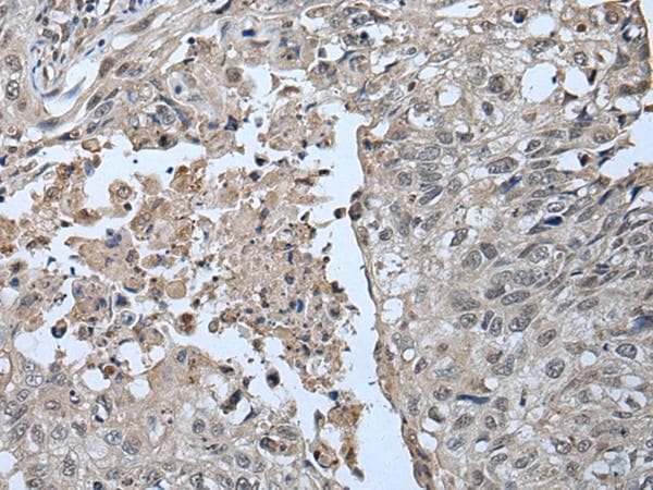 UBR2 Antibody