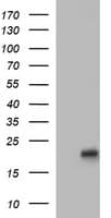 LMO2 Antibody (clone OTI1D7)