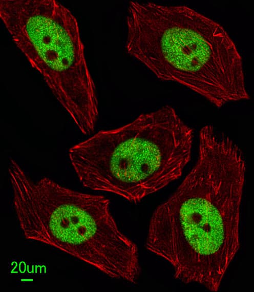 FEN1 Antibody (aa243-272)