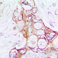 Polyclonal Rabbit anti-Human LAMA5 / Laminin Alpha 5 Antibody (Internal, IHC, WB)