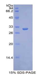 Human GPC4 / Glypican 4 Protein (Recombinant His)