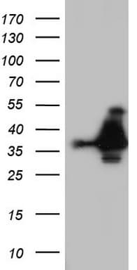 NKX3-1 Antibody (clone OTI1F5)