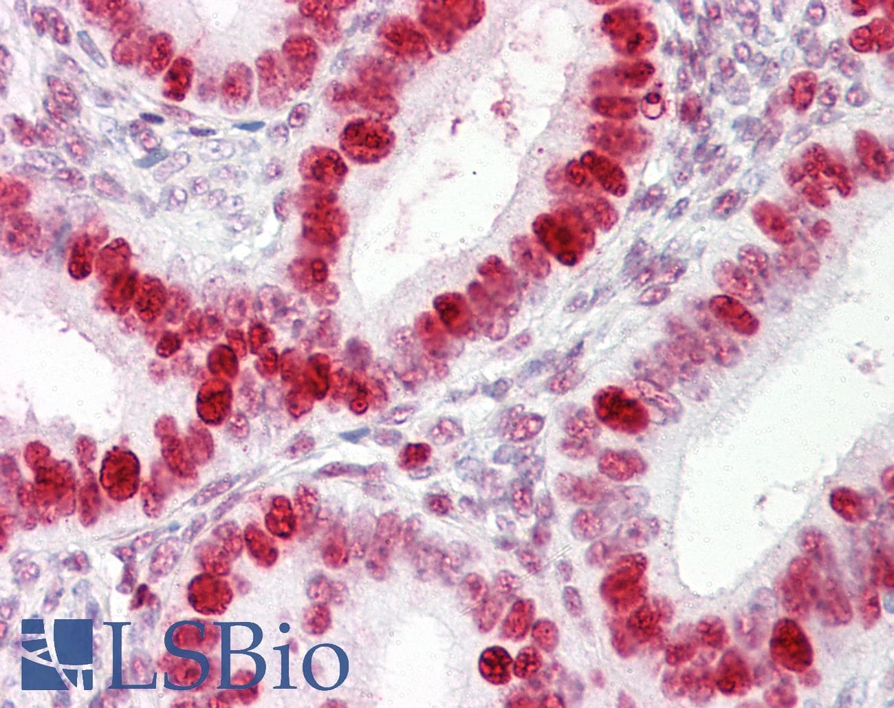 PathPlus™ Monoclonal Mouse anti-Human PCNA Antibody (clone PC10 (a.k.a. 3F81), IHC, WB)