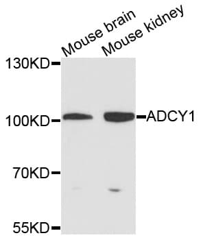 ADCY1 / Adenylate Cyclase 1 Antibody