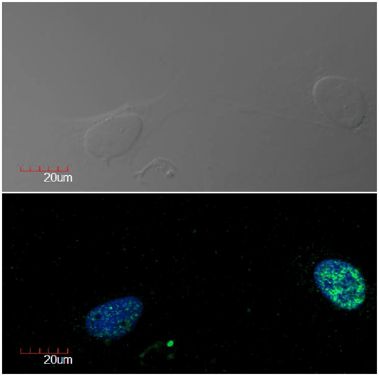 MKI67 / Ki67 Antibody (clone Ki-67)