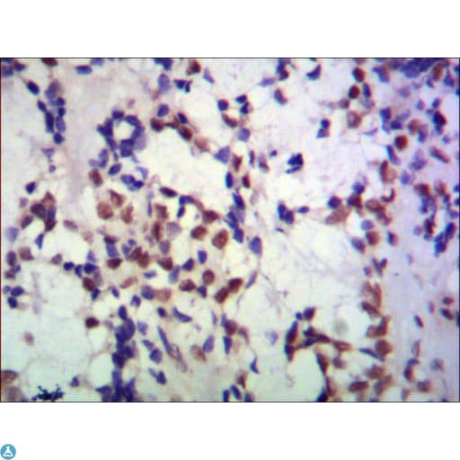 TBL1XR1 / TBLR1 Antibody