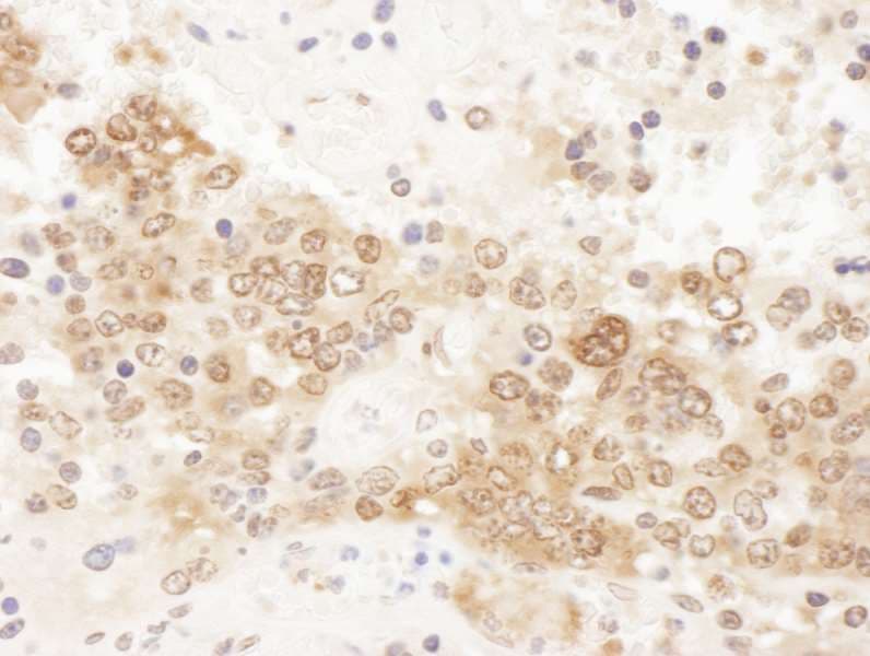 CLNS1A Antibody (aa187-237)