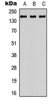 CML / BCR Antibody (N-Terminus)
