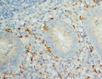 Polyclonal Rabbit anti-Human IL8 / Interleukin 8 Antibody (aa77-95, IHC, WB)