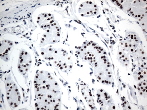 Monoclonal Mouse anti-Human GTF3C4 Antibody (clone OTI4A3, aa583-822, IHC, WB)