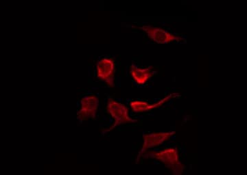 RAF1 / RAF Antibody (phospho-Ser621)