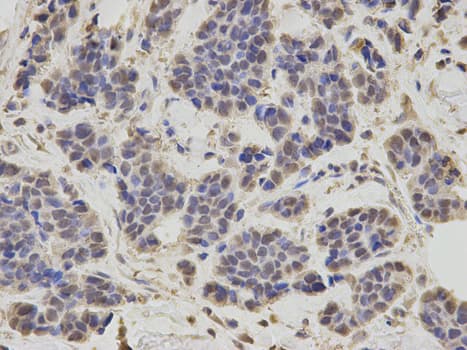 RNF2 / RING2 / RING1B Antibody