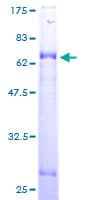 Human ACAD8 Protein (Recombinant GST)