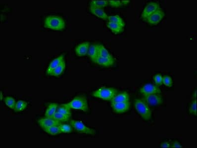 IHC-plus™ Polyclonal Rabbit anti-Human CD71 / Transferrin Receptor Antibody (aa 94-754, IHC, IF, WB)