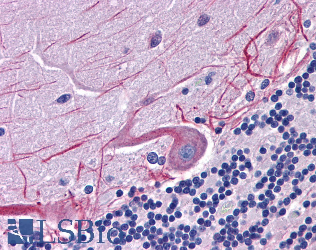 IHC-plus™ SKA1 Antibody