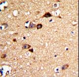 UNC5H3 / UNC5C Antibody (aa188-217)
