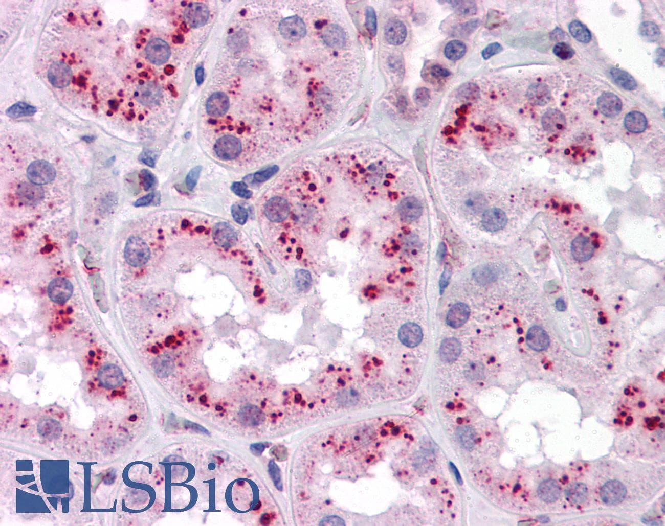 IHC-plus™ ZMYM4 / ZNF262 Antibody