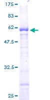 Human PPP1R3B Protein (Recombinant GST)