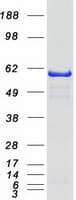 Human NMT1 Protein (Recombinant Myc-DDK (Flag))