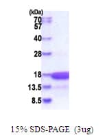 Human HMGN3 Protein (Recombinant His)