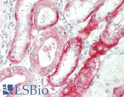 IHC-plus™ ADCY9 / Adenylate Cyclase 9 Antibody (N-Terminus)