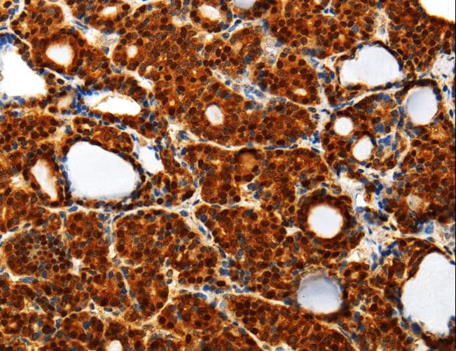 TXN / Thioredoxin / TRX Antibody